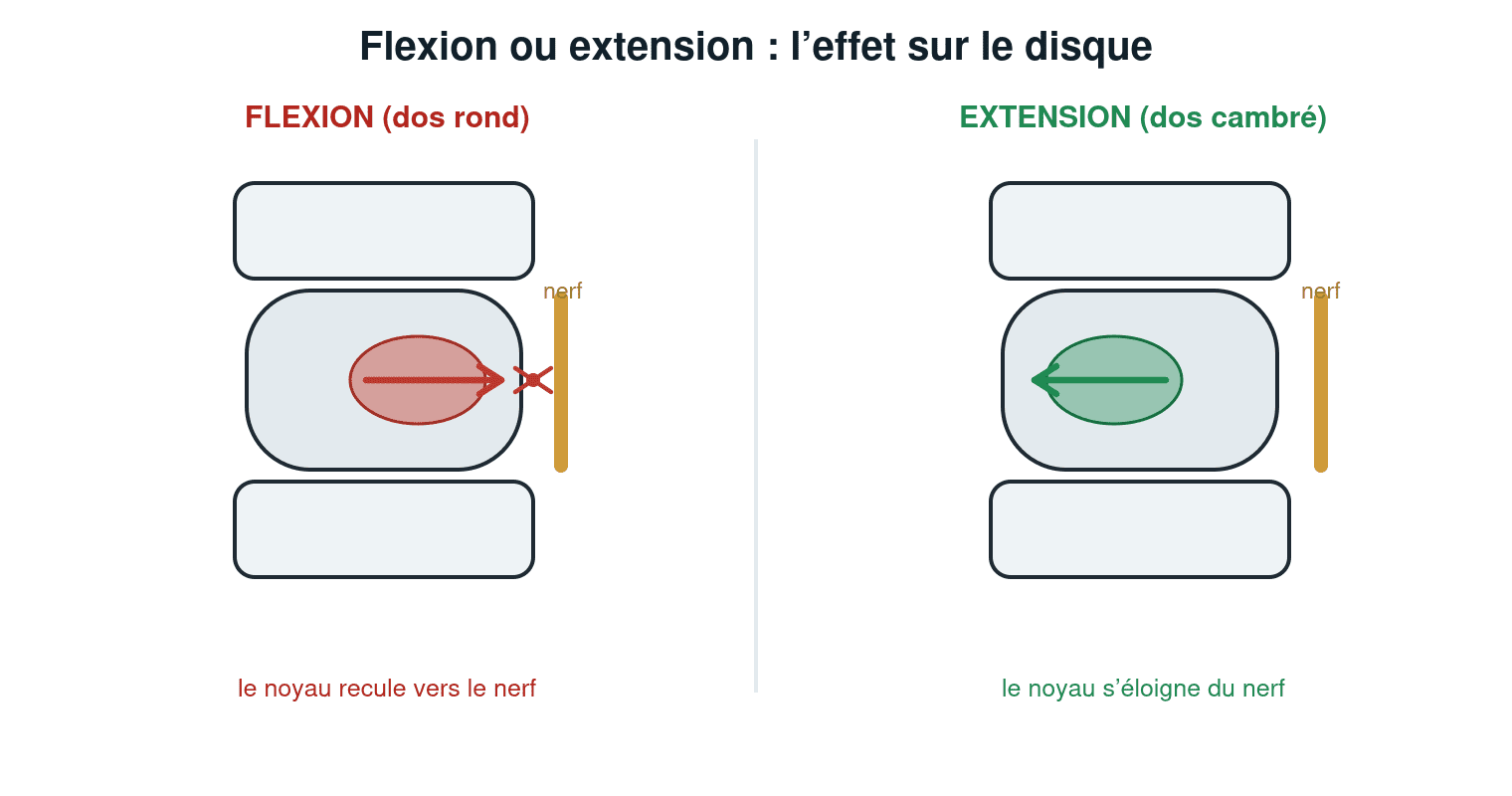 Schéma : en flexion (dos rond) le noyau du disque recule vers le nerf, en extension (dos cambré) il s'en éloigne