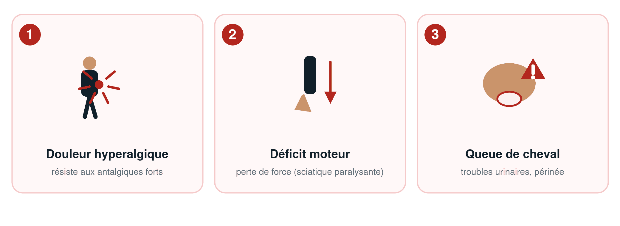 Les 3 signaux d'urgence de la sciatique : douleur hyperalgique, déficit moteur (sciatique paralysante), syndrome de la queue de cheval